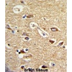 Translocase of Outer Mitochondrial Membrane 70A (TOMM70A) Antibody