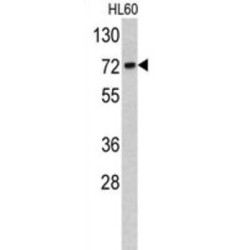 Translocase of Outer Mitochondrial Membrane 70A (TOMM70A) Antibody