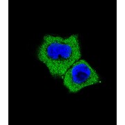 Mothers Against Decapentaplegic Homolog 7 (Smad7) Antibody