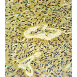 Mothers Against Decapentaplegic Homolog 7 (Smad7) Antibody