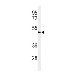 Mothers Against Decapentaplegic Homolog 7 (Smad7) Antibody