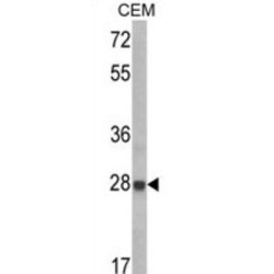 Insulin Like Growth Factor Binding Protein 6 (IGFBP6) Antibody