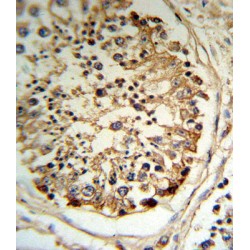 Tissue-Type Plasminogen Activator (PLAT) Antibody
