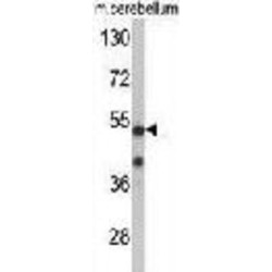 Cyclin-Dependent Kinase 14 (PFTK1) Antibody