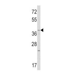 Proto-Oncogene Wnt-1 (WNT1) Antibody