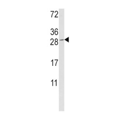 Granzyme M (GZMM) Antibody