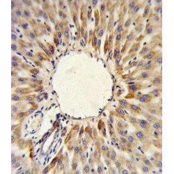 Hydroxymethylglutaryl-CoA Synthase, Mitochondrial (HMGCS2) Antibody