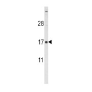 Follicle Stimulating Hormone Beta (FSHB) Antibody