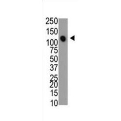 Myotubularin Related Protein 4 (MTMR4) Antibody