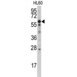 Myotubularin (MTM1) Antibody