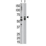 Myotubularin (MTM1) Antibody