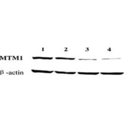 Myotubularin (MTM1) Antibody