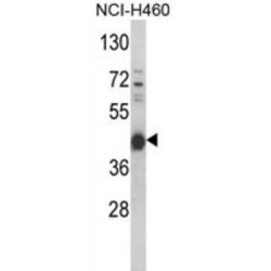 Protein Kinase, cAMP Dependent Catalytic Alpha (PRKACA) Antibody