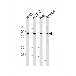 Transcription Factor P65 (RELA) Antibody