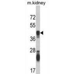 Argininosuccinate Synthase (ASS) Antibody