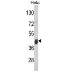 Argininosuccinate Synthase (ASS) Antibody