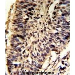 Small Nuclear Ribonucleoprotein D2 Polypeptide (SNRPD2) Antibody