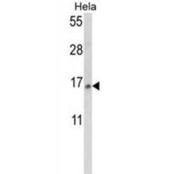 Small Nuclear Ribonucleoprotein D2 Polypeptide (SNRPD2) Antibody