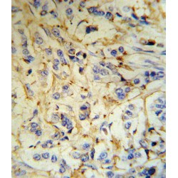 Fibrinogen Alpha (FGA) Antibody