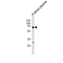 Fibrinogen Alpha (FGA) Antibody