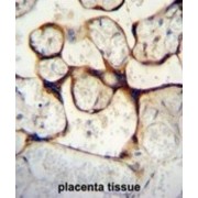 Endothelin Converting Enzyme 1 (ECE1) Antibody