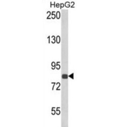 Endothelin Converting Enzyme 1 (ECE1) Antibody