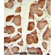 Aspartoacylase (ASPA) Antibody