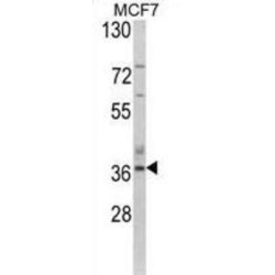 Aspartoacylase (ASPA) Antibody