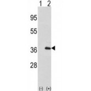 Interleukin-1 Alpha (IL1A-S87) Antibody