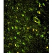 KH-Type Splicing Regulatory Protein (KHSRP) Antibody