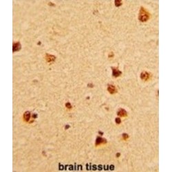 KH-Type Splicing Regulatory Protein (KHSRP) Antibody