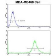 Galactose-1-Phosphate Uridylyltransferase (GALT) Antibody