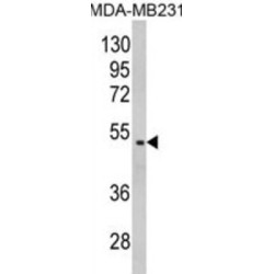 Galactose-1-Phosphate Uridylyltransferase (GALT) Antibody