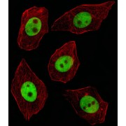 General Transcription Factor III (GTF2I) Antibody