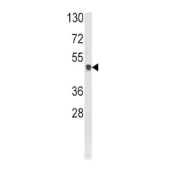 Glutamine Synthetase (GLUL) Antibody