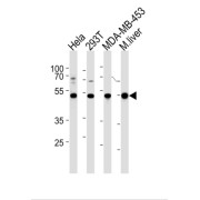 Glutathione Synthetase (GSS) Antibody