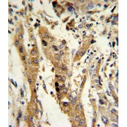 Glutathione S Transferase Mu 1 (GSTM1) Antibody