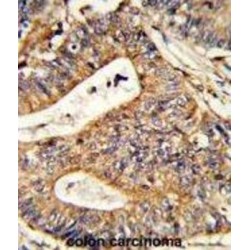 Calreticulin (CALR) Antibody