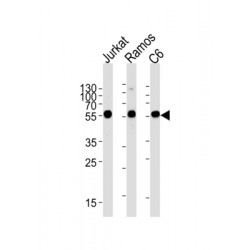 Calreticulin (CALR) Antibody