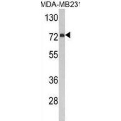 Dimethylaniline Monooxygenase [N-Oxide-Forming] 3 (FMO3) Antibody