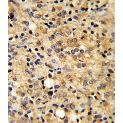 Cartilage Oligomeric Matrix Protein (COMP) Antibody