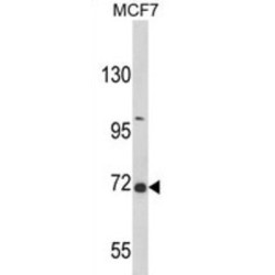 GRB2-Associated-Binding Protein 2 (GAB2) Antibody