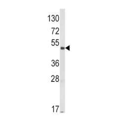 MAPK/MAK/MRK Overlapping Kinase (MOK) Antibody