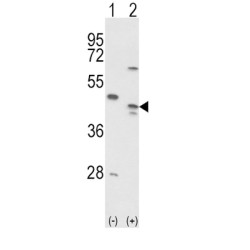 MAPK/MAK/MRK Overlapping Kinase (MOK) Antibody