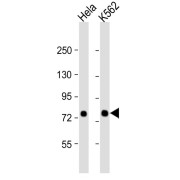 WB analysis of (1) HeLa, and (2) K562 whole cell lysates, using SRP72 antibody (1/1000 dilution). Blocking/Dilution buffer: 5% NFDM/TBST. Calculated MW: 75 kDa.