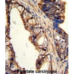 Transglutaminase 4, Prostate (TGM4) Antibody