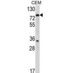 Transglutaminase 4, Prostate (TGM4) Antibody