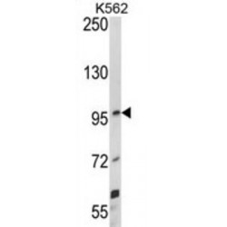 Netrin Receptor UNC5C (UNC5C) Antibody