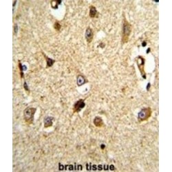 Transitional Endoplasmic Reticulum ATPase (VCP) Antibody