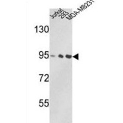 Transitional Endoplasmic Reticulum ATPase (VCP) Antibody